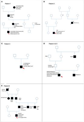 Cardiovascular Involvement in Pediatric Laminopathies. Report of Six Patients and Literature Revision